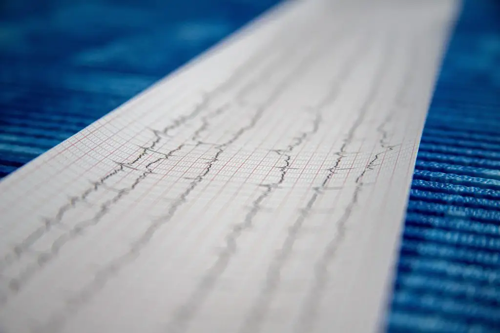 Waar vind ik het telefoonnummer van cardiologie 8e etage?